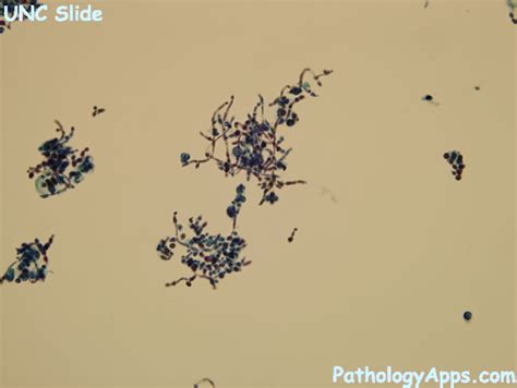 Candida Cytology