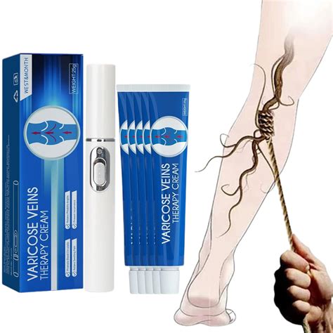 Amazon LONGLUAN Blue Light Therapy Varicose Veins Pen Cream