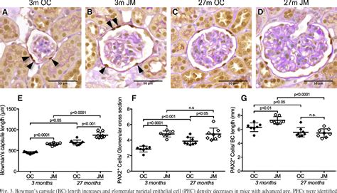 PDF Changes In Glomerular Parietal Epithelial Cells In Mouse Kidneys