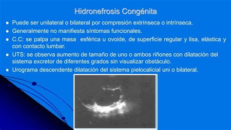 Tumores abdominales en el niño en Imagenología PPT Descarga Gratuita