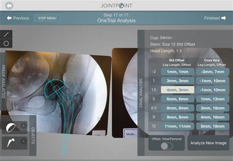 DePuy Synthes Partners for Exclusive Access to Proprietary Hip ...