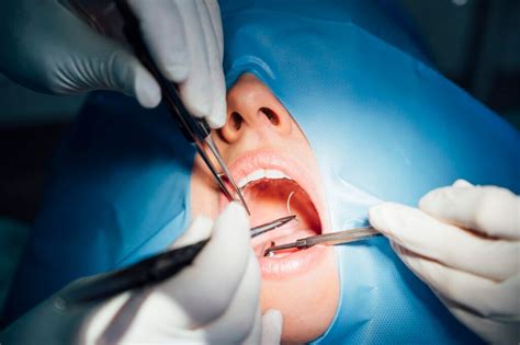 Minor Oral Surgery In Kuala Lumpur The Best Archident Dental Clinic