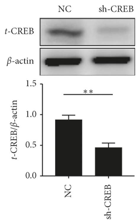 Hyperoside Regulates MiR 34a Through The ERK CREB Pathway A