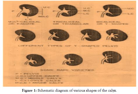 Morphological Study Of Pelvicalyceal System Of Kidney In Human Ca