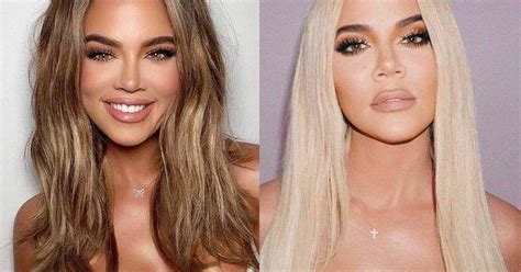 Khloé Kardashian reaparece y sorprende con su look y nueva cirugía de