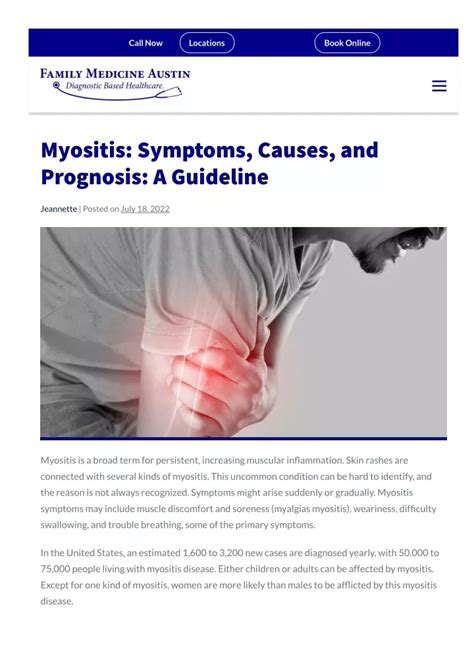 PPT - myositis-symptoms-causes-and-prognosis- PowerPoint Presentation, free download - ID:11476858