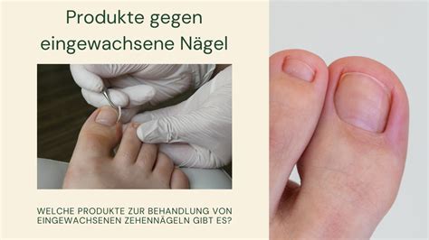 Produkte gegen eingewachsene Nägel Fusspflegeblog