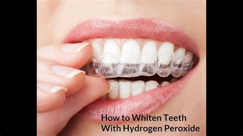 How To Whiten Teeth With Hydrogen Peroxide Youtube