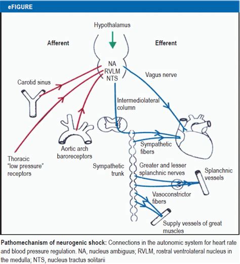 Hypovolemic Shock Pathophysiology