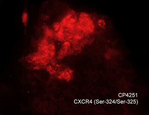 ECM Bioscience CXCR4 Phospho Regulation Antibody Sampler Kit ECM