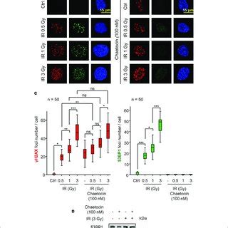 Chaetocin Impairs The Assembly Of Bp Foci In Response To Ionizing