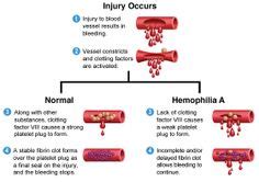 Hemophilia