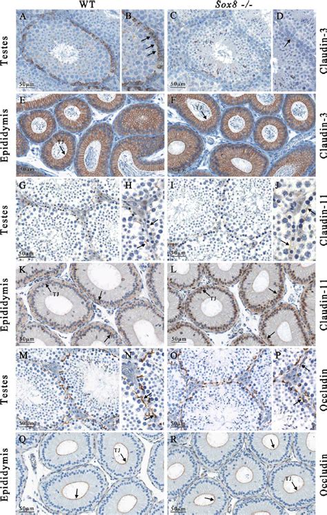 Immunohistochemical Analysis Illustrates The Expression Of Tight