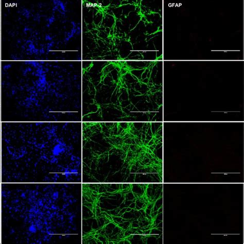 Murine Cortical Neurons In Primary Cultures Are Differentiated As