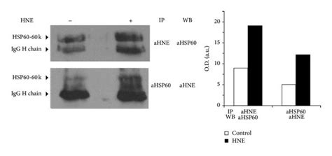 Immunoprecipitation And Western Blot Analysis Of Hsp60 Expression And