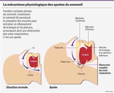 Lapn E Du Sommeil Emp Che De R Cup Rer Et Fatigue Le C Ur Planete Sante