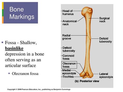 Head Bone Marking