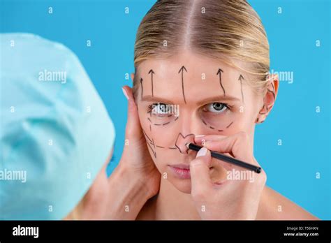 Beautician Draw Correction Lines On Woman Face Before Plastic Surgery