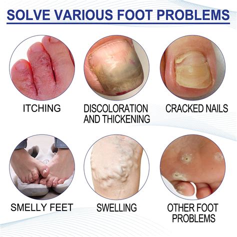 Foot Soak for Toenail Repair, 10pcs Softens Calluses, Soothes Sore and