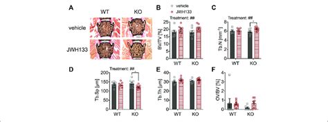 Jwh Increased Trabecular Bone Volume In Mice A Undecalcified