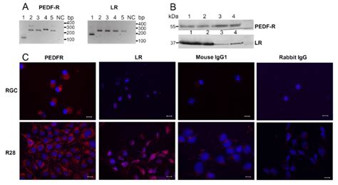 Primary Retinal Ganglion Cells Rgc And R28 Cells Express Pedf R And