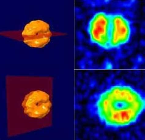 Portable MRI – clinicalneuroengineering.com