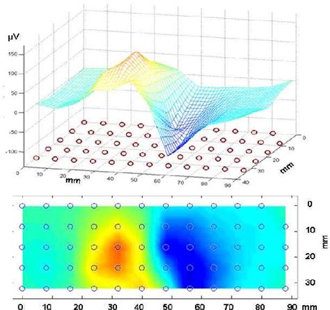 Figure 4 From 1 TWO DIMENSIONAL HIGH DENSITY SURFACE EMG HD EMG