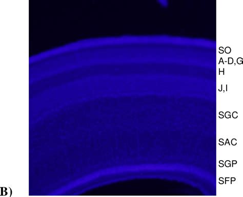 Figure From The Expression Profile Of Kiaa Like In Chick Embryos