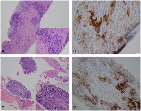 Cancer Cytopathology On Twitter New Today Pd L Evaluation Shows