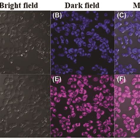 Confocal Fluorescence Images Of HeLa Cells Incubated With Sensor 1 20