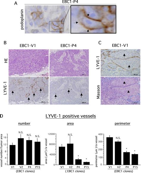 Suppressive Effect Of Tumor Cell Associated Podoplanin On Tumor