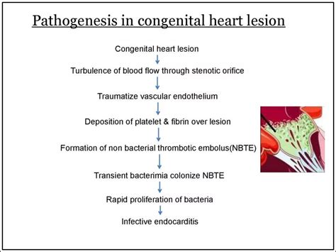 Infective Endocarditis Paediatrics Ppt