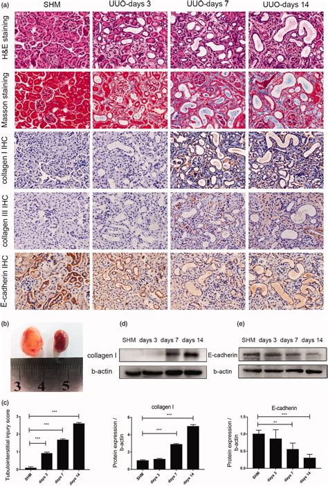 Renal Interstitial Fibrosis In Uuo Mouse Models A H E Staining Of