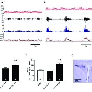 Effect of bicuculline injection into the paraventricular nucleus of the ...