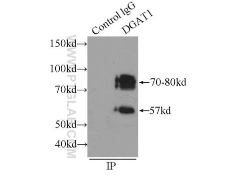 Dgat Rabbit Anti Human Mouse Rat Polyclonal Proteintech L