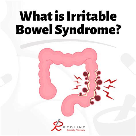 What Is Irritable Bowel Syndrome IBS Redline Specialty Pharmacy