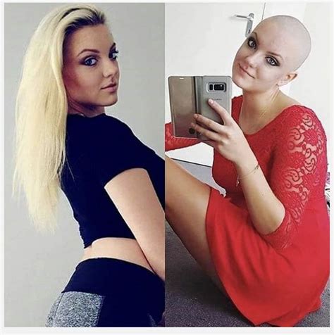 Pin By David Connelly On Hair Before After Shaved Hair Women