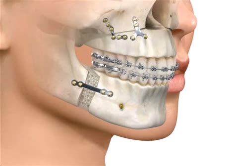 La cirugía maxilofacial Clinica Dental Miradent