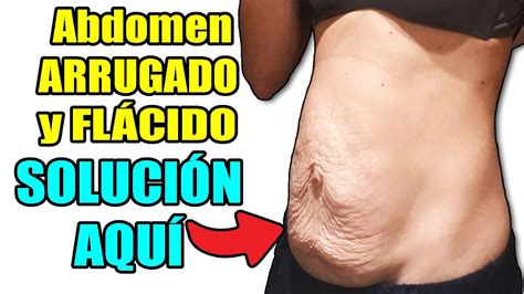 Abdomen Bajo HORRIBLE Que Hago FUNCIONA Solo Haz ESTO YouTube