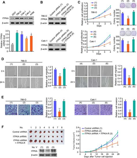 ITPKA Promotes RCC Proliferation Migration And Invasion Both In Vitro