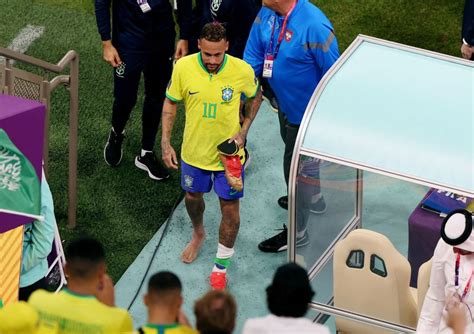 Así Quedó El Tobillo De Neymar Tras La Lesión En El Triunfo De Brasil Ante Serbia El