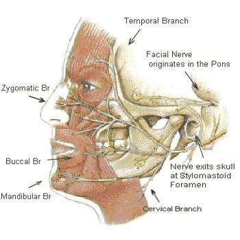 The Facial Nerve Bells Palsy