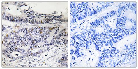 Anti Rb1 Retinoblastoma Rb Antibody Rabbit Anti Human Lsbio