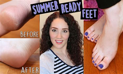 How To Remove Dead Skin For Summer Ready Feet Youtube