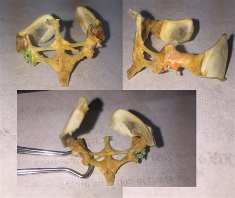 Bio Lab Frog Sternum Pectoral Girdle Diagram Quizlet