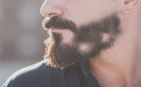 How To Make Your Beard Grow In Bald Spots My Beard Gang