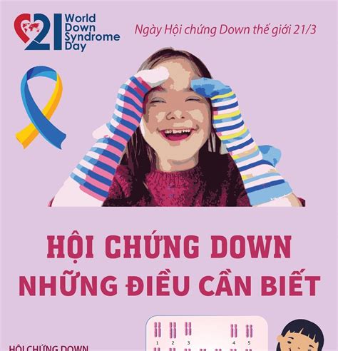 Ngày Hội Chứng Down Thế Giới 213 Hội Chứng Down Những điều Cần Biết