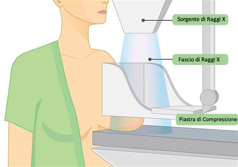 Mammografia cos è il mammografo e come funziona