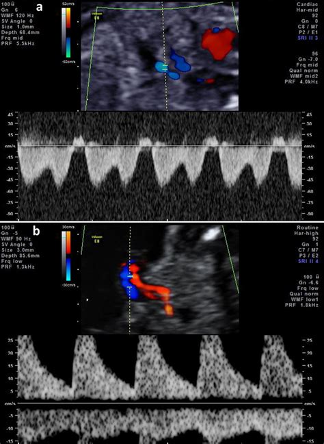 J Med Cases