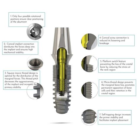 Bone Level Implant Bilimplant